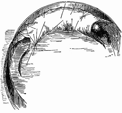 Fig. 145.—